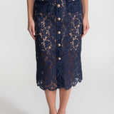 Çiçek Dantelli Midi Elbise – Lacivert